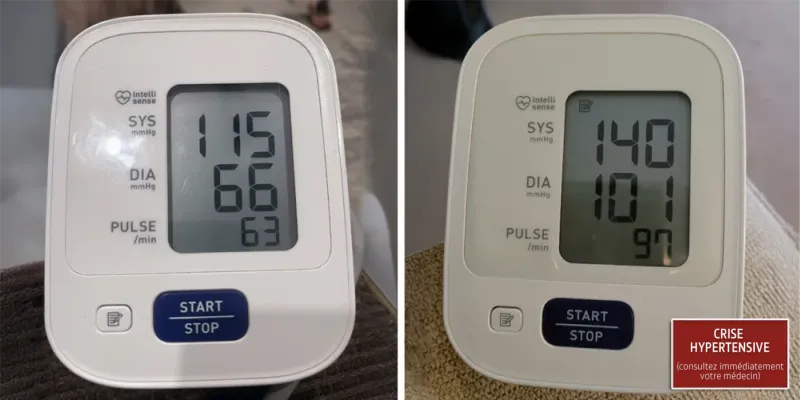 Derila - Crise hypertensive et apnée du sommeil